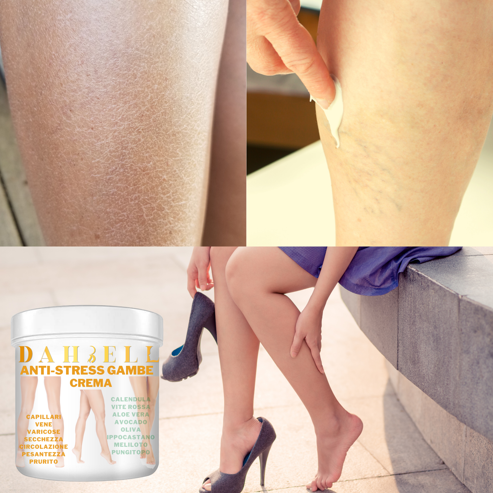 10 Rmed Per Le Vene Varcose A Base D Erbe | Rmed, Vene Varcose, Rmed Natural - Foto 4